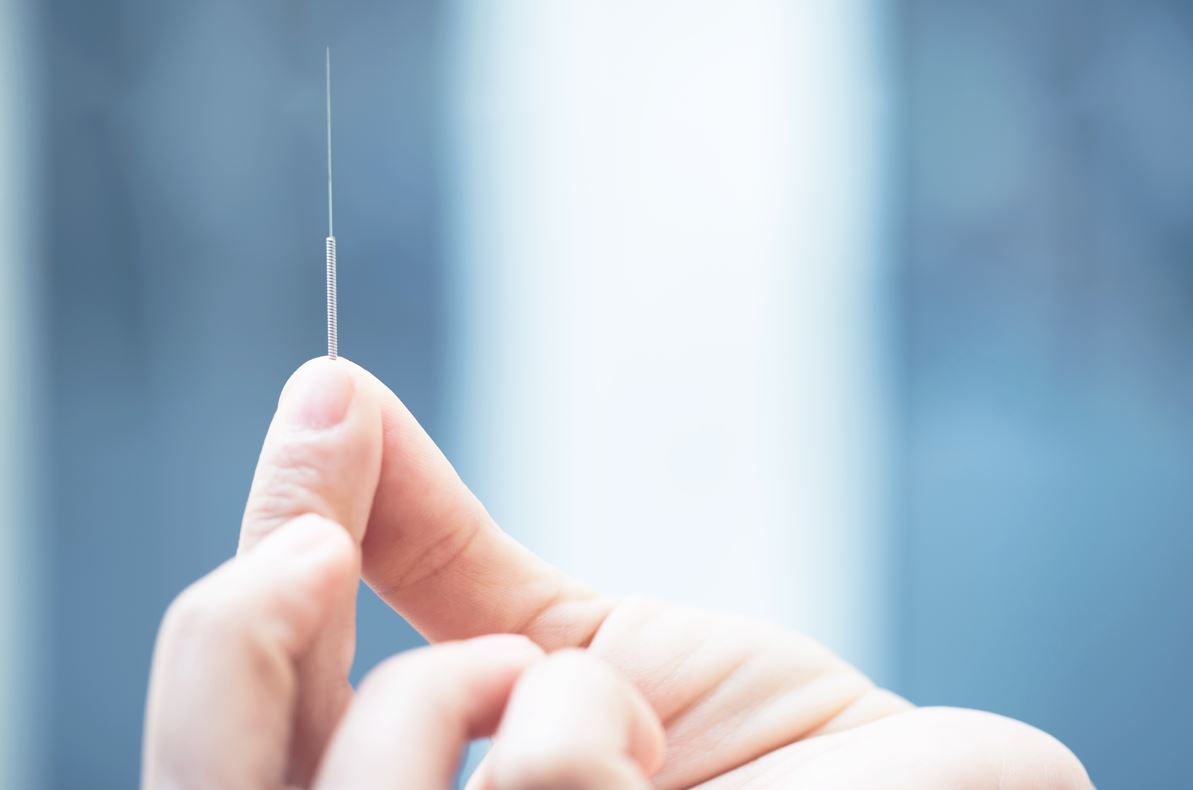 Acupuncture Newcastle